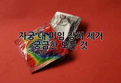 자궁 내 피임 장치 제거, 궁금한 모든 것!